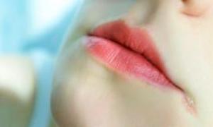 Маленькие проблемы беременности: от чего трескаются уголки губ